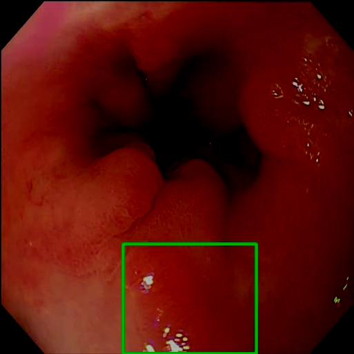 Adjust Brightness - L1 (Moderate)