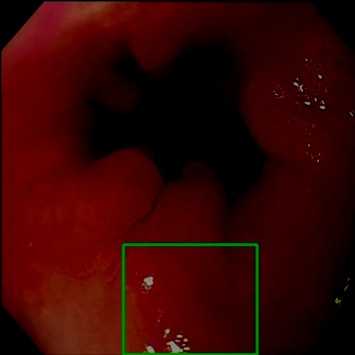 Adjust Brightness - L2 (Severe)