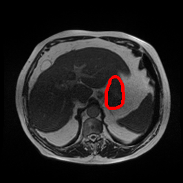 Bias Field Artifact - L0 (Original)