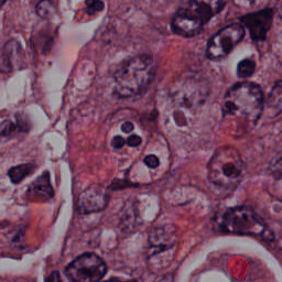 Blood Cell Artifact - L1 (Moderate)