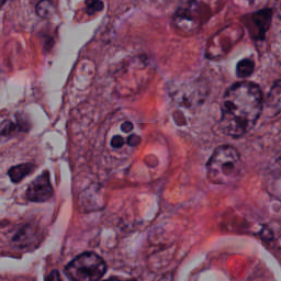 Blood Cell Artifact - L2 (Severe)