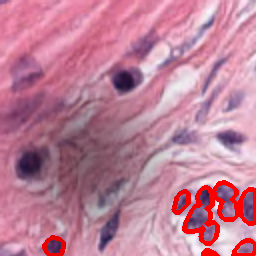 Dark Spots Artifact - L1 (Moderate)