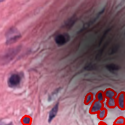 Dark Spots Artifact - L2 (Severe)