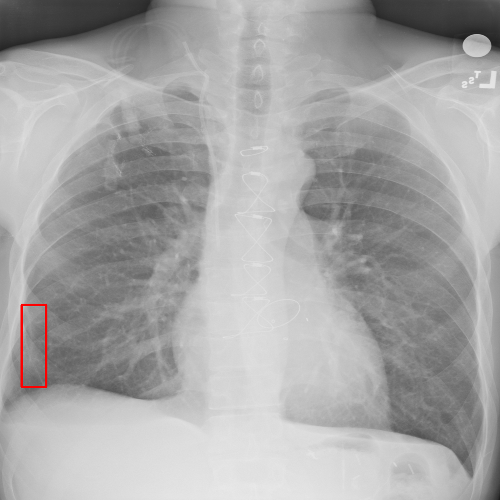 Low Resolution - L0 (Original)