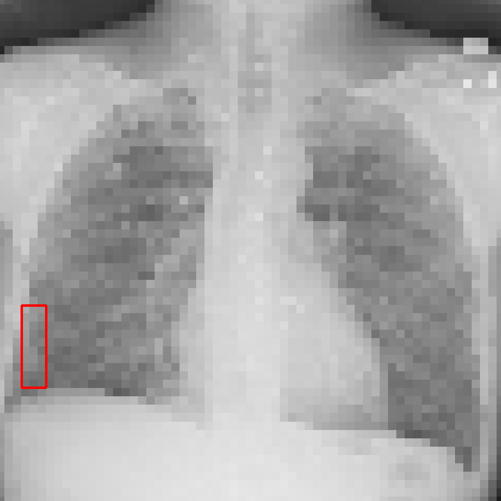 Low Resolution - L2 (Severe)