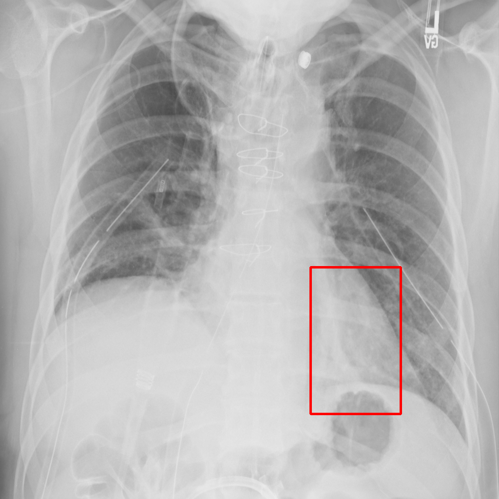 Exposure - L0 (Original)