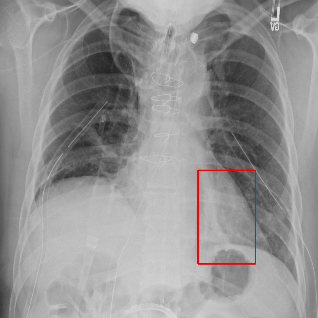 Exposure - L1 (Moderate)