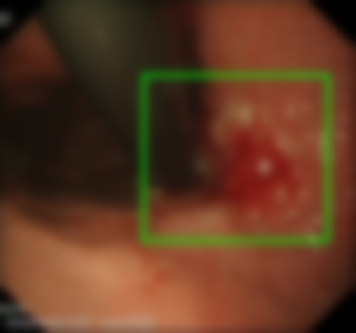 Gaussian Blur - L2 (Severe)