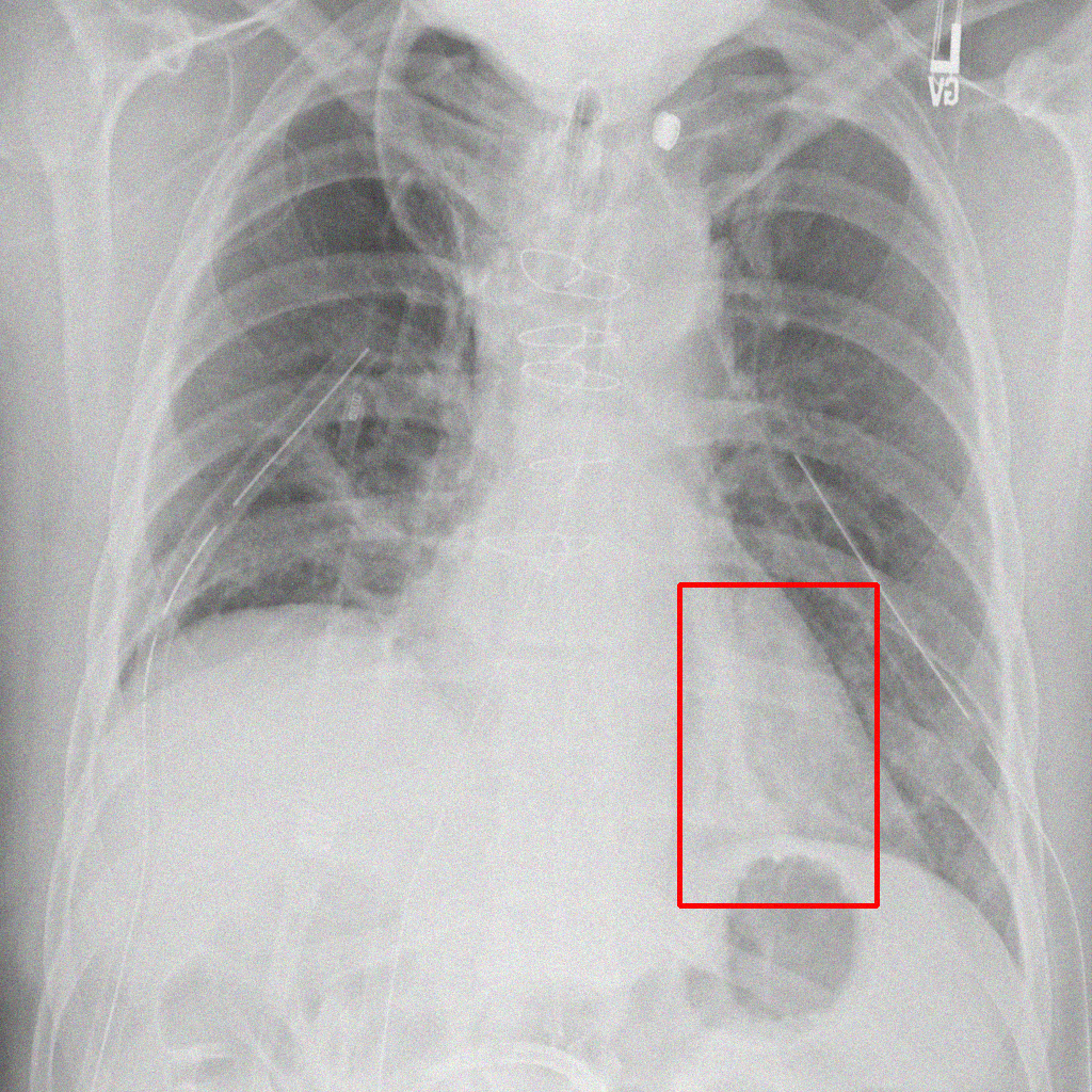 Gaussian Noise - L1 (Moderate)