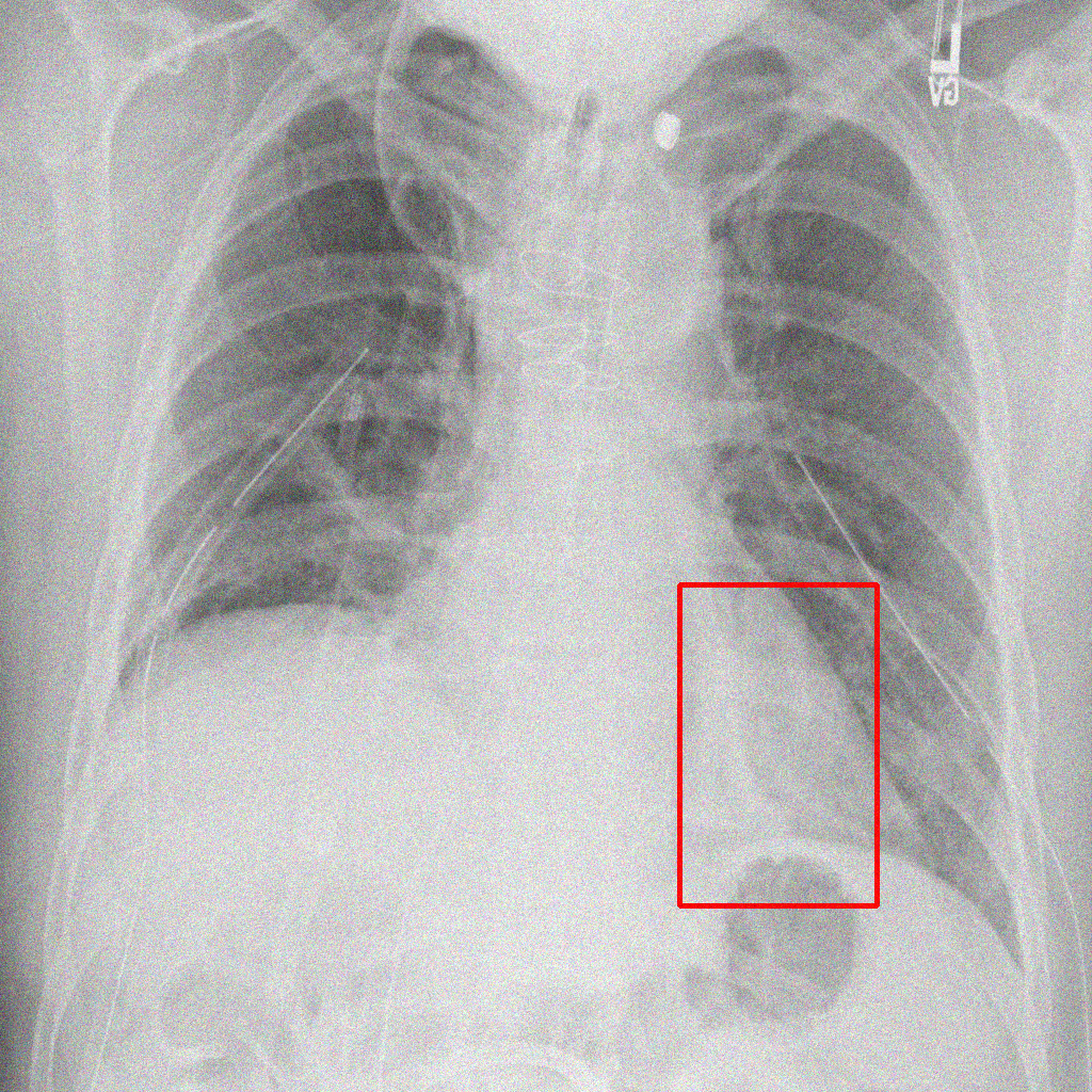 Gaussian Noise - L2 (Severe)
