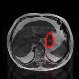 Ghosting Artifact - L1 (Moderate)