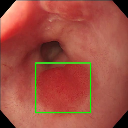 Motion Blur - L0 (Original)