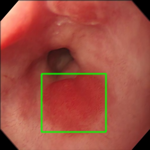 Motion Blur - L1 (Moderate)