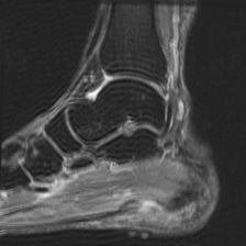 Object Movement - L1 (Moderate)