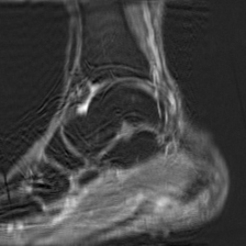 Object Movement - L2 (Severe)