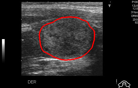 Reduce Contrast - L0 (Original)