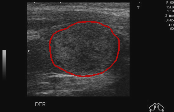 Reduce Contrast - L1 (Moderate)