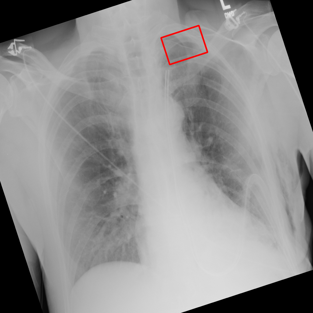 Object Rotation - L1 (Moderate)