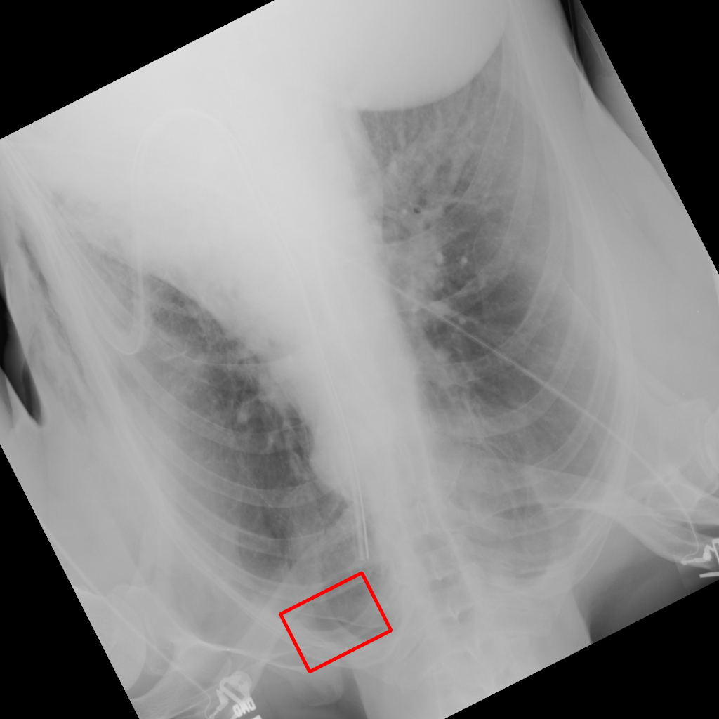 Object Rotation - L2 (Severe)