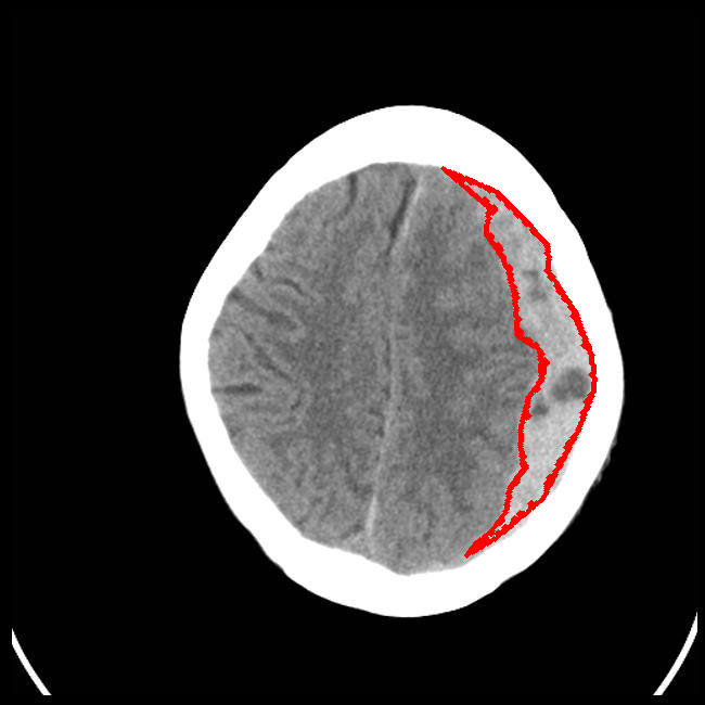 Sparse View - L0 (Original)