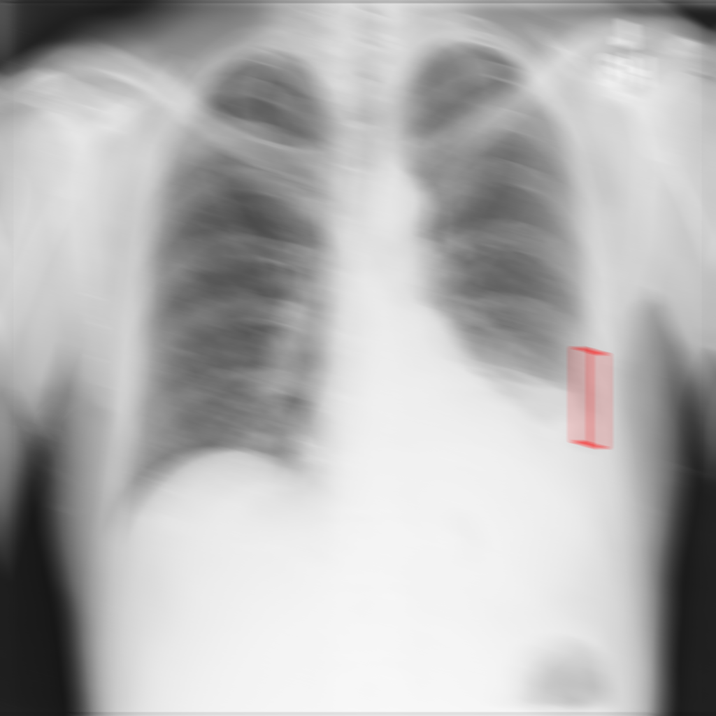 X-ray Motion Blur - L2 (Severe)