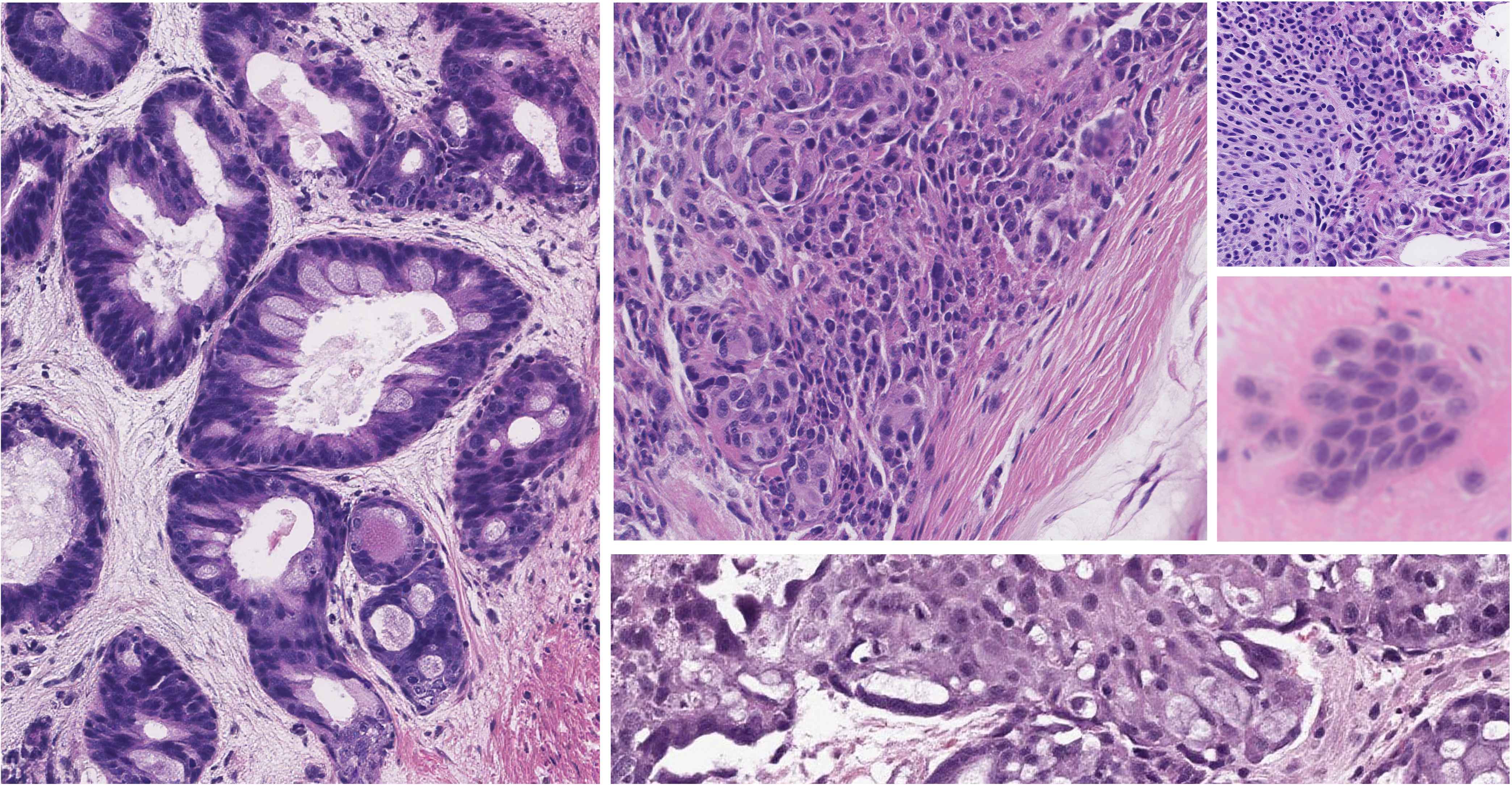 Histopathology