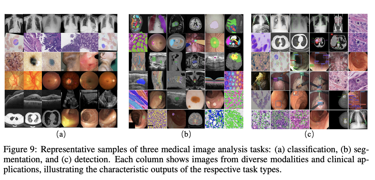 Representative samples: classification, segmentation, detection