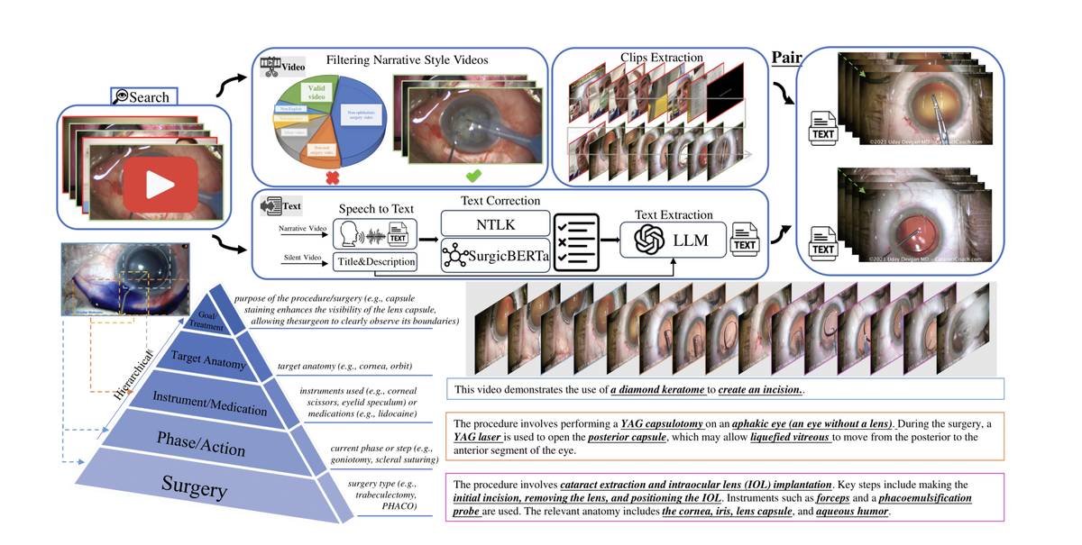 OphVL construction pipeline: video collection, filtering, ASR transcription, text denoising, and clip-text pairing
