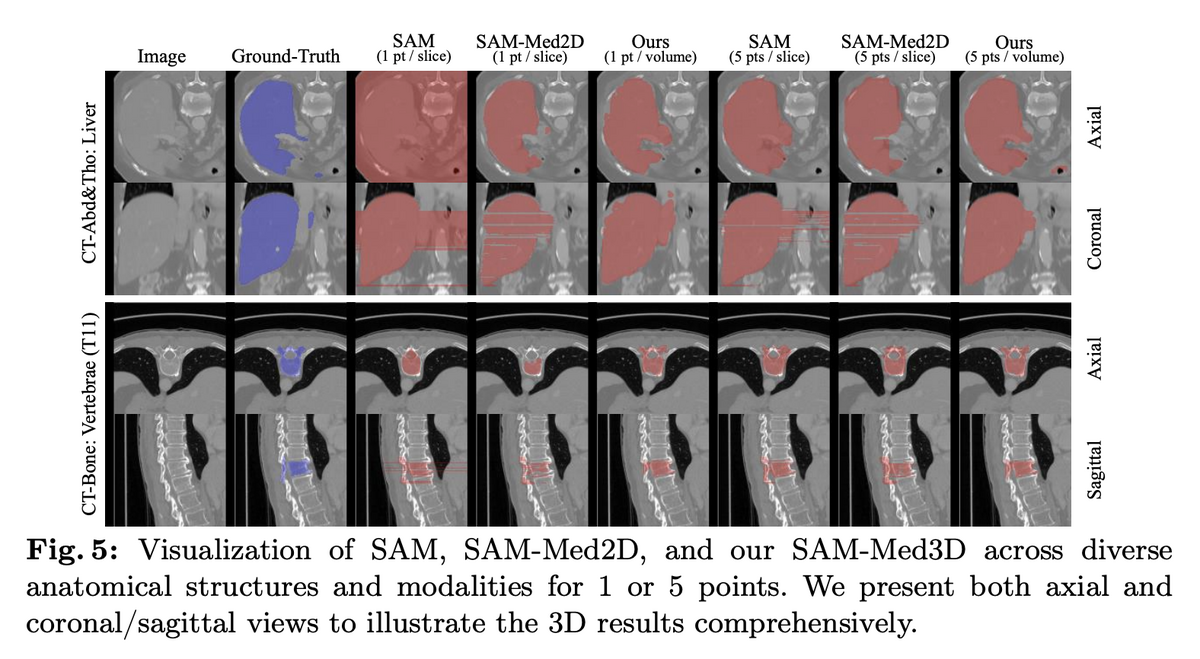 SAM-Med3D qualitative visualisation across anatomical structures