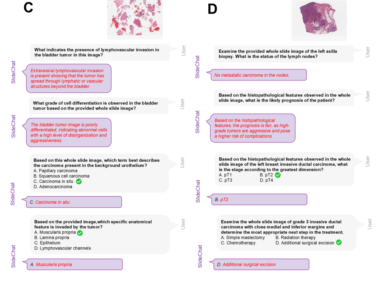 SlideChat clinical conversations: bladder tumor and breast carcinoma multi-turn diagnostic Q&A