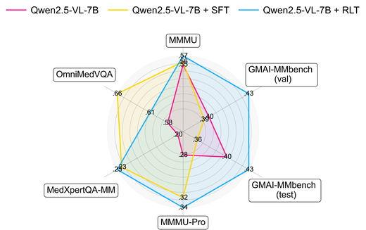 GMAI-VL-R1: Harnessing Reinforcement Learning for Multimodal Medical Reasoning