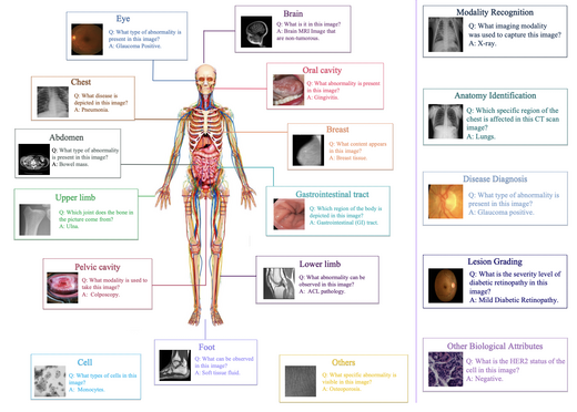 OmniMedVQA: A New Large-Scale Comprehensive Evaluation Benchmark for Medical LVLM