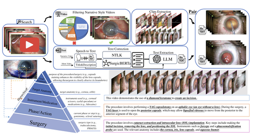 OphCLIP: Hierarchical Retrieval-Augmented Learning for Ophthalmic Surgical Video-Language Pretraining