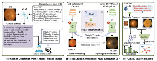 RetinaLogos: Fine-Grained Synthesis of High-Resolution Retinal Images Through Captions
