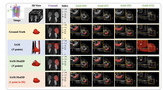 SAM-Med3D: Towards General-purpose Segmentation Models for Volumetric Medical Images